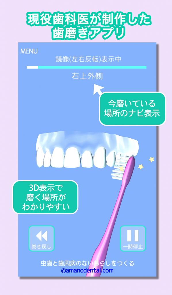歯磨きアプリ/歯磨き貯金1